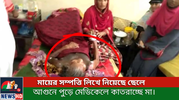 মায়ের সম্পত্তি লিখে নিয়েছে ছেলে আগুনে পুড়ে মেডিকেলে কাতরাচ্ছে মা