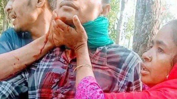 ‎আদিতমারীতে পারিবারিক কলহে যুবকের আত্মহত্যার চেষ্টা, নিজের লিঙ্গ ও গলা কাটলেন যুবক